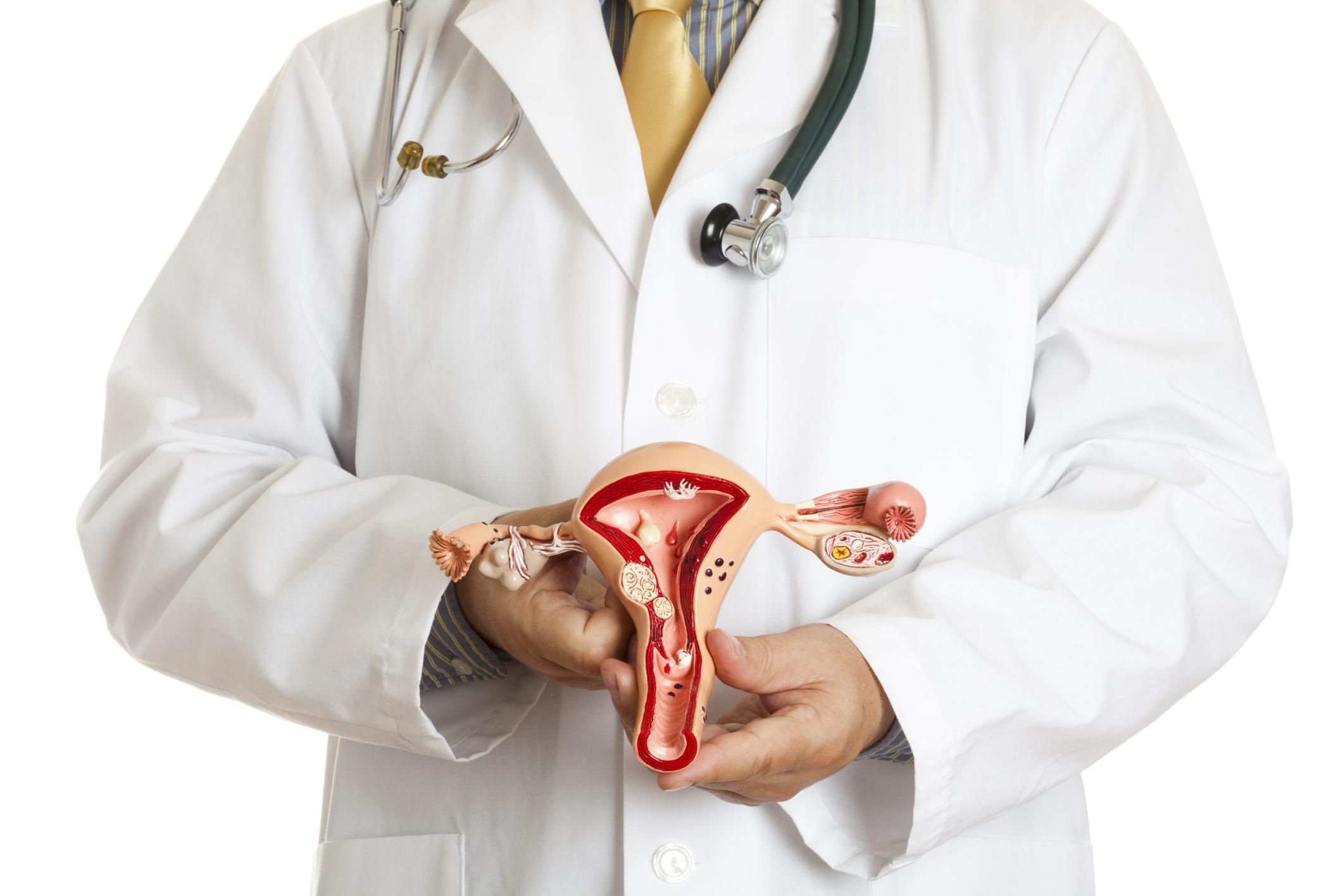 Miyom (Fibroid) Çeşitleri