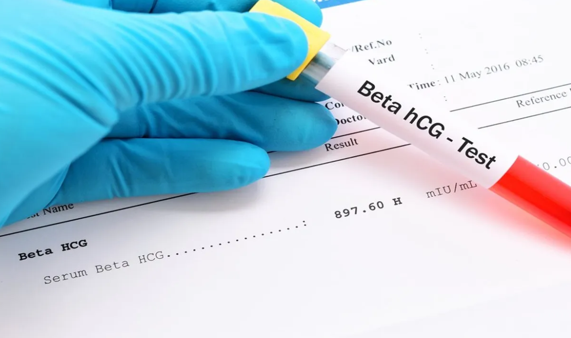 Beta HCG Testi Nedir?