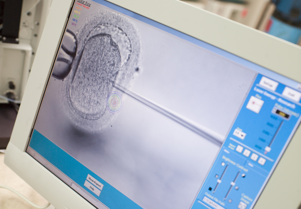 IVF Treatment Guide in Türkiye for International Patients